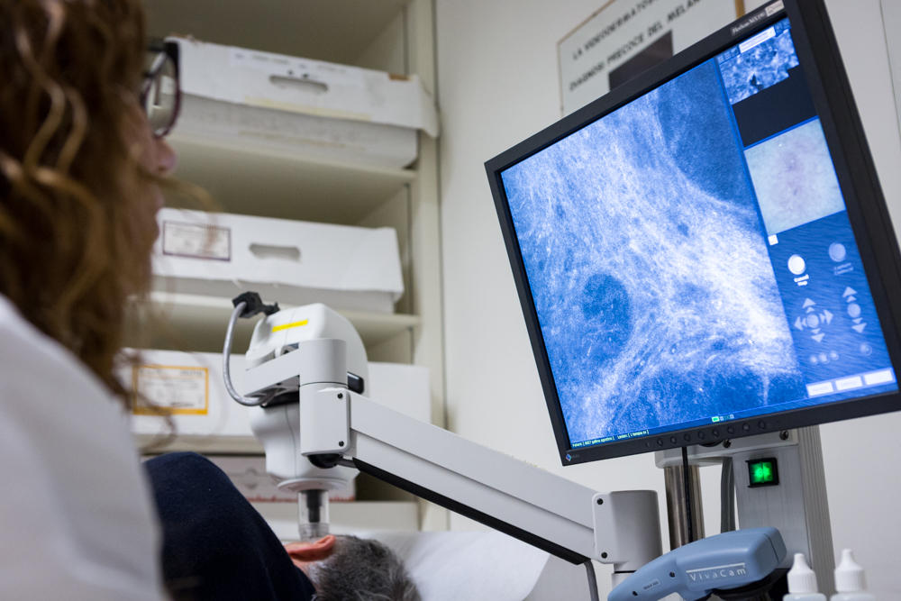 La Microscopia laser confocale: un super occhio per la diagnosi precoce
