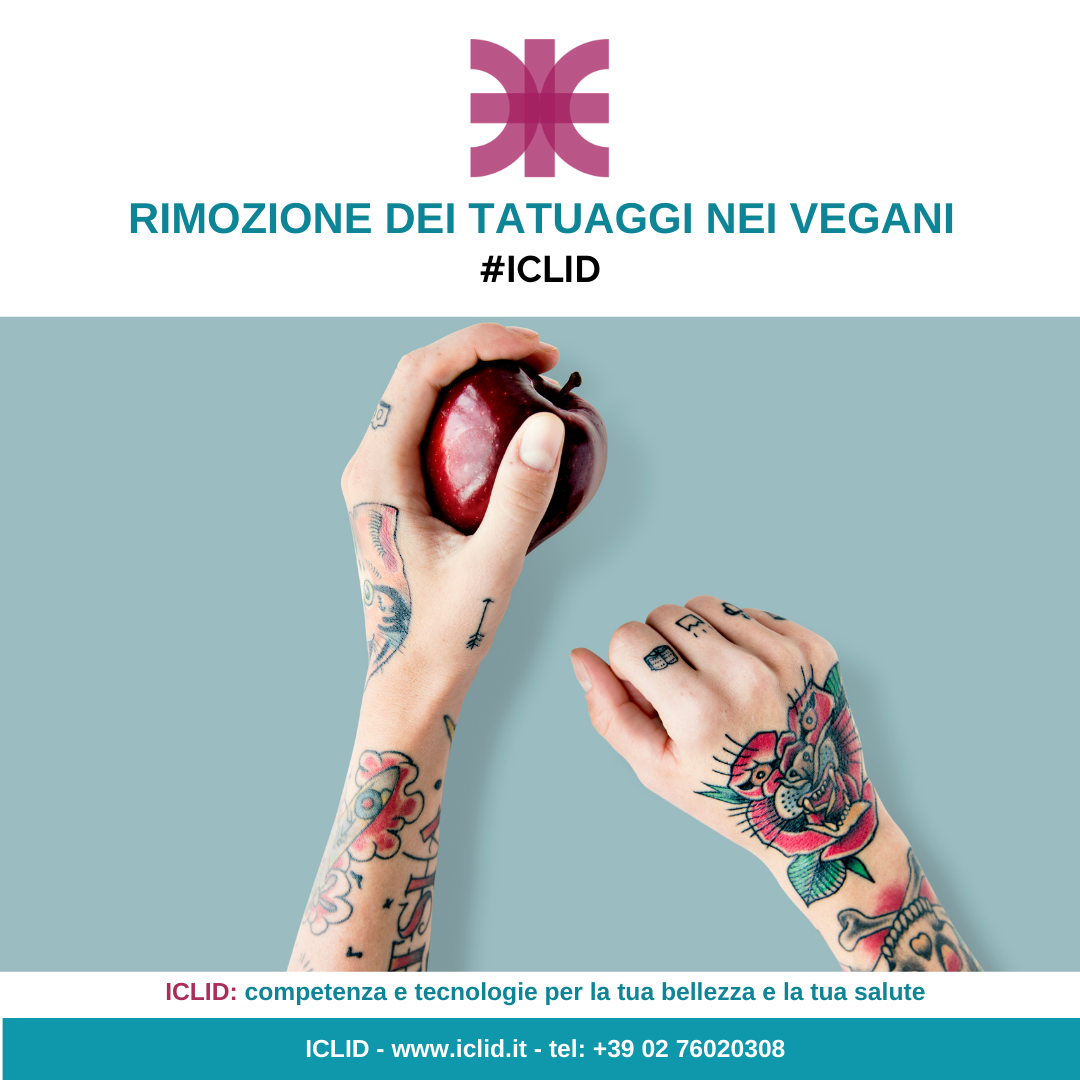 Nuova ricerca internazionale sulla Rimozione dei tatuaggi nei vegani