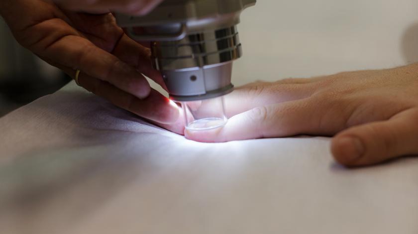 capillaroscopia digitale