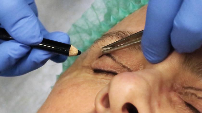 ICLID blefaroplastica preparazione