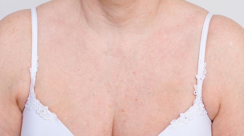 ICLID fotodanneggiamento nordlys SWT_POST