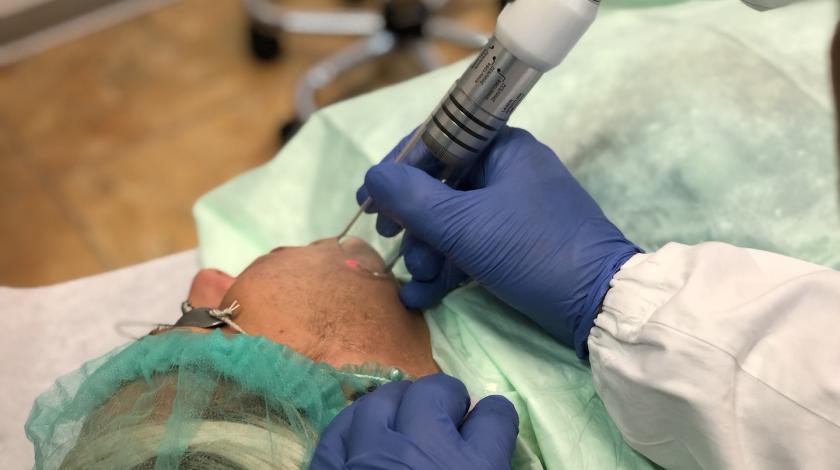 hollywood laser Peel Carbonio 3