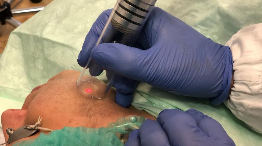 Hollywood Laser Peel Carbonio 1